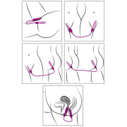 Adrien Lastic 2X Fjernbetjent Dobbelt Vibrator