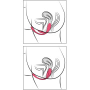 Sweet Smile Dobbelt Fjernbetjent Vibrator Æg